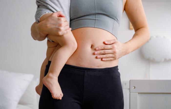 Lifestyle Habits That Support Scar Healing