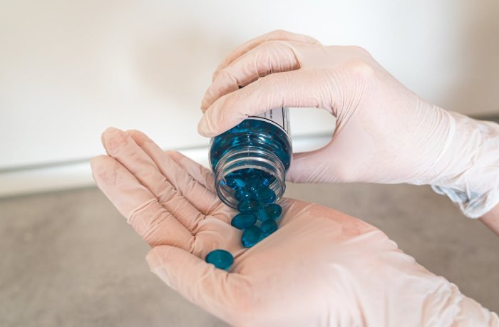 Topamax for Migraine Prevention