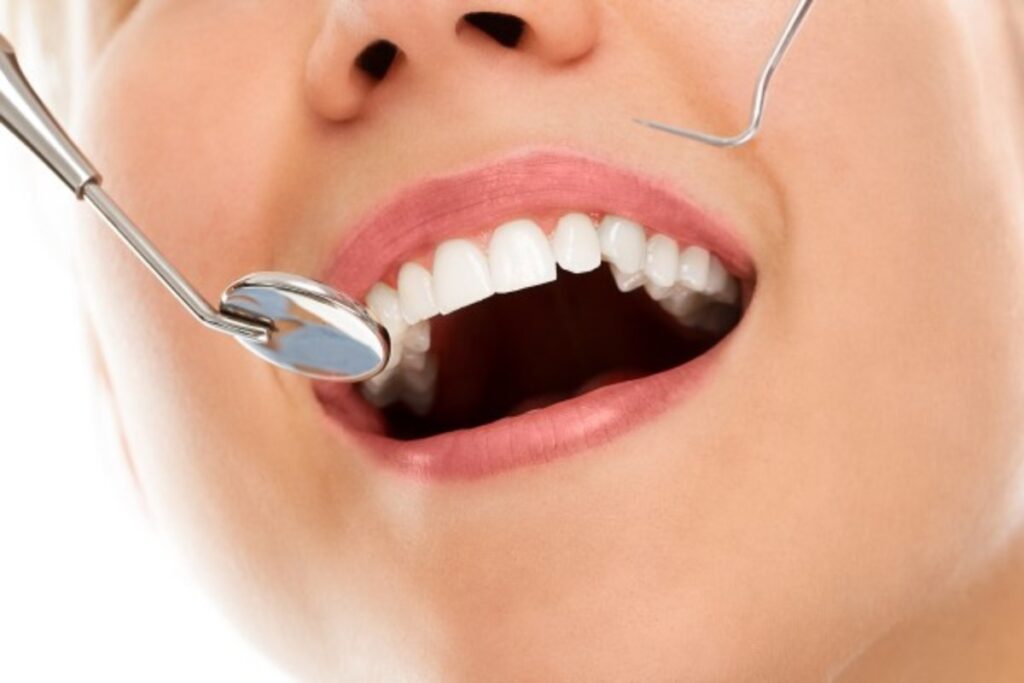Dentist for a Checkup
