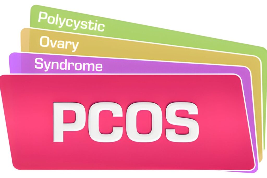 A Complete Guide to PCOS: Symptoms and Treatments PCOS