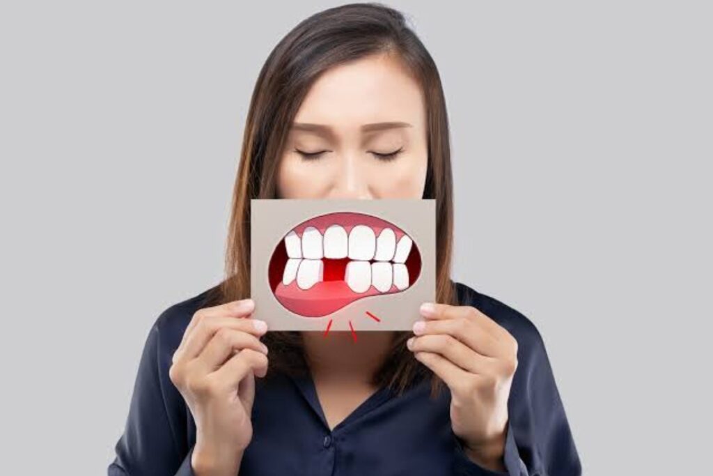 Tooth Loss